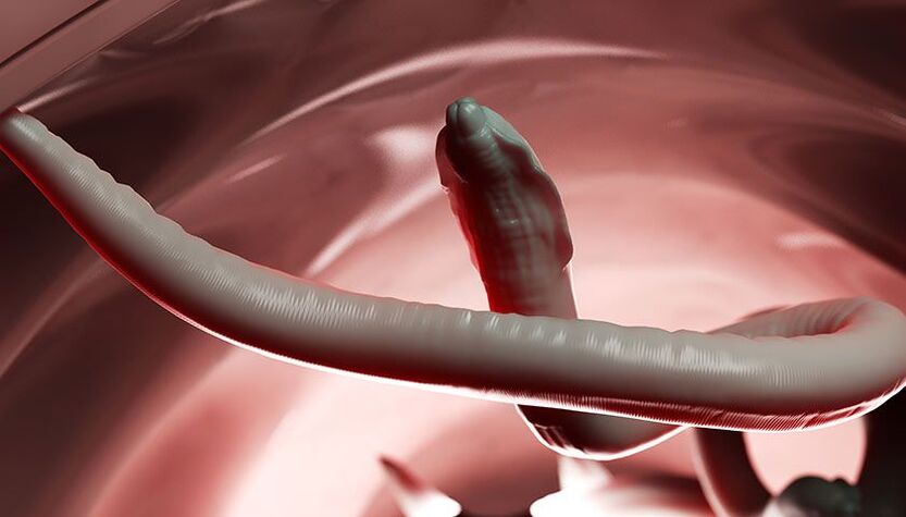 intestinal worms in the human body