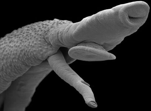 parasite organism
